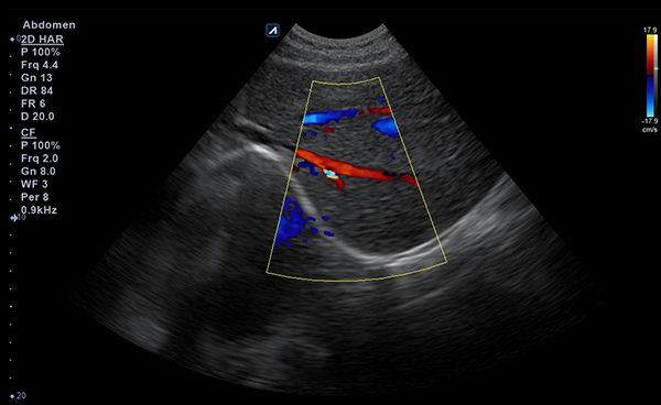 Abdomen slide image03