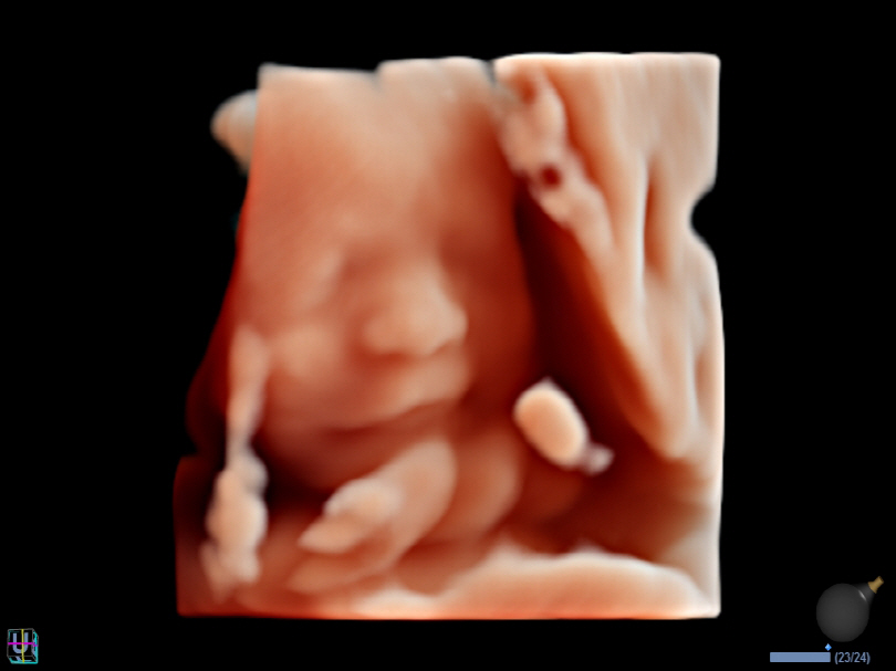 Fetal Face in Live HQ™