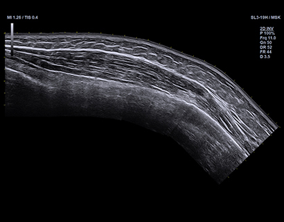 Panoramic Imaging