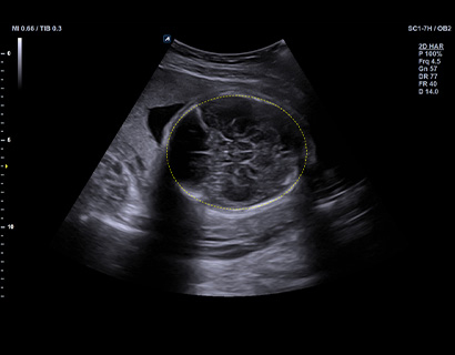X+ Auto Biometry