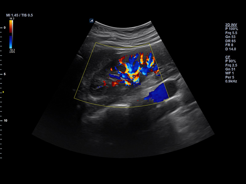 Kidney_Color mode
